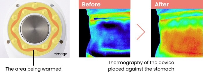 Cavispa RF Core PLUS thermography of the warmed area